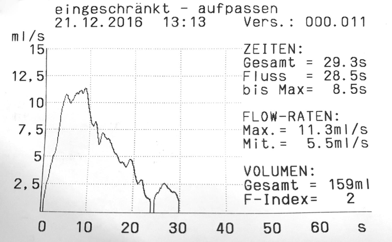 Bild einer Uroflowmetrie-Messung